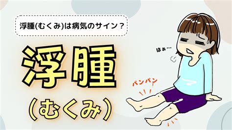 浮腫病|むくみ（浮腫）は病気のサインかも？症状や主な原因。